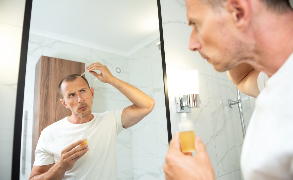 Minoxidil depois do transplante capilar: devo continuar a usar?